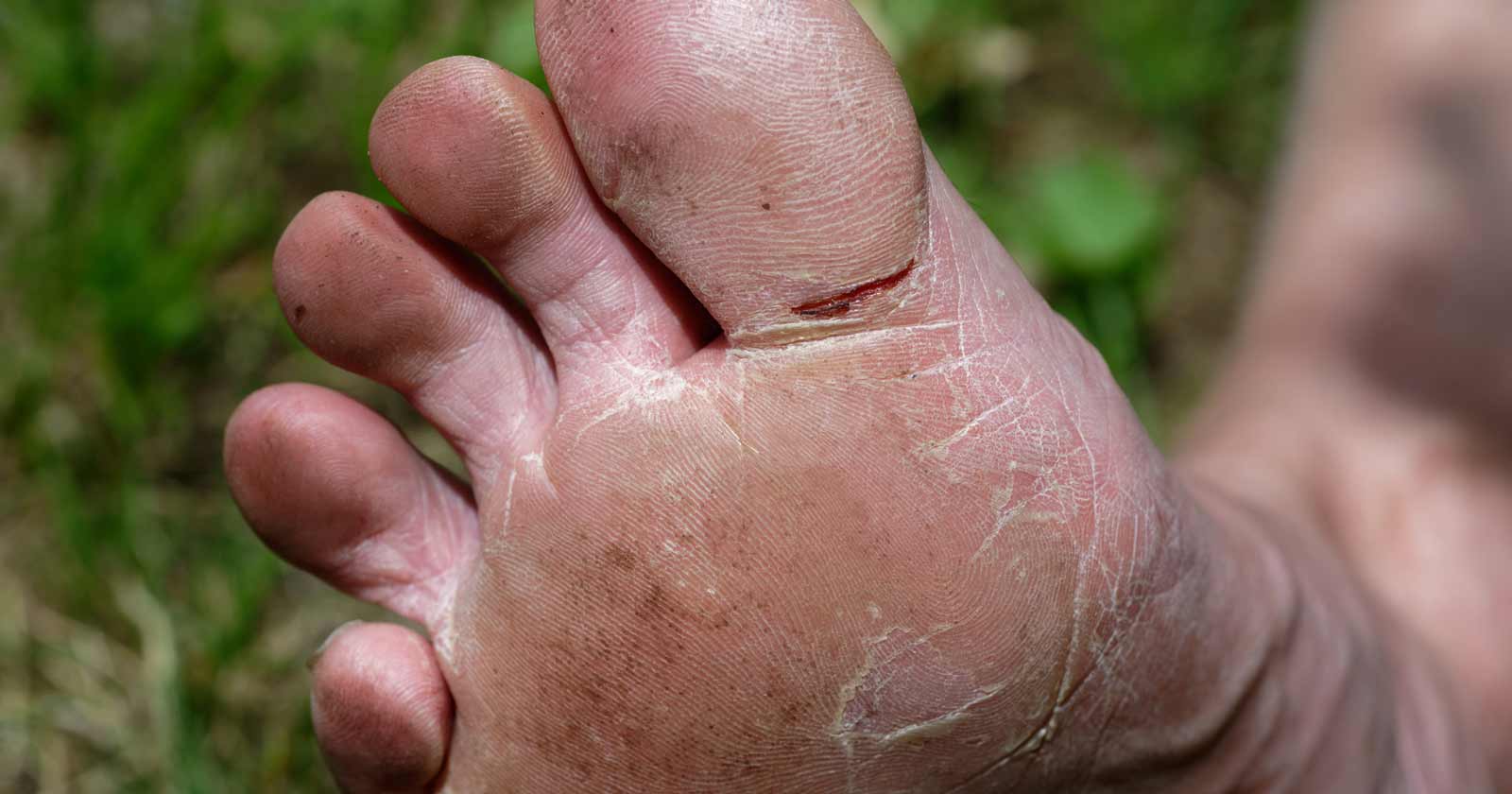 The challenge of wet feet
